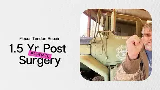 1.5 Years Post Pinky Tendon Surgery &ndash; What Still Feels Different #handinjury #tendoninjury