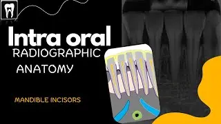 Normal radiographic anatomical landmark/ Intraoral Radiographic Anatomy of the mandible incisors