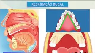 Respiração Bucal e suas consequências - Prof. German Ramirez