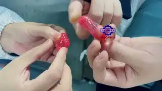 Peeling gummies making machine full automatic jelly candy production line