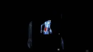 GATISST DE DESORDENES MUSCULOESQUEL&Eacute;TICOS 