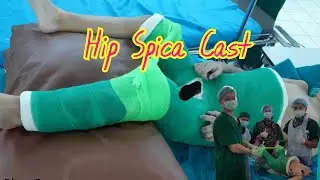 Hip spica cast in OR