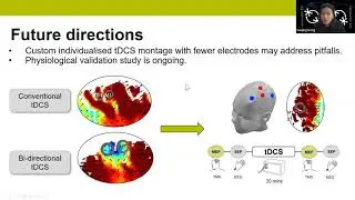 Talk: Bi-directional tDCS produces anterior and posterior current flow in neighbouring cortical tar&hellip;