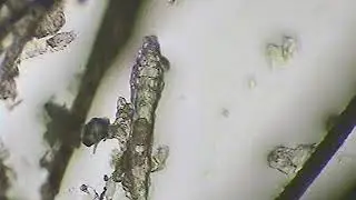 Demodex mites