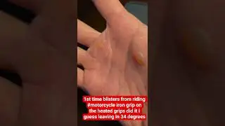 Мозоли от езды на мотоцикле, видимо, виноваты железные грипсы на подогреваемых рукоятках, оставле...