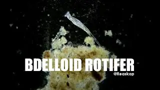 Bdelloid Rotifer
