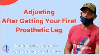 Adjusting To Your New Capabilities After Getting Your First Prosthetic Leg