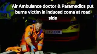 Severe Burns, Swelling Airway &mdash; Critical Care Team Races Against Time