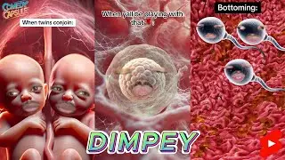 TRY NOT TO LAUGH WATCHING IMDIMPEY COMEDY | ULTIMATE DIMPEY SKITS COMPILATION