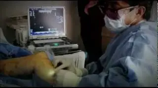 Endovenous Laser Treatment (EVLT)