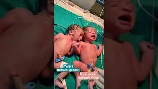 Dizygotic Twins #aiims #neetmotivation #mbbs #doctoronduty