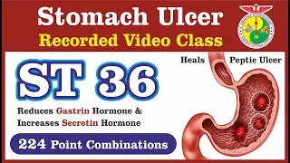 ST-36 புள்ளி & அல்சர் (வயிற்றுப்புண்) | Stomach Ulcer #acupuncture #acupressure #ulcer #tcm