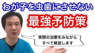 【シーラント、溝埋め】子供の奥歯は要注意！！実際の治療シーンは後半で