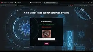 Skin Disease Classification Using CNN | Deep Learning Project / AI