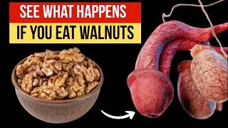 See What Happens if You Eat Walnuts Every day?
