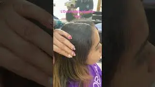 L&rsquo;Or&eacute;al scalp advanced spa for dandruff and hair fall @Sandymuahair  -9955591655
