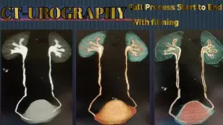 CT Urography Full Procedure In Hindi.#ivp kaise kare