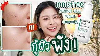 กู้ผิวพังจากการเป็นสิวด้วย Retinol Cica Repair จาก innisfree | MAYNESSA