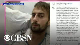 Lady Gaga's dog walker recounts being shot in Los Angeles