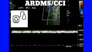 Continuous Doppler Waveform