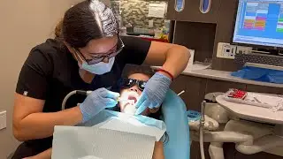 Dental cleaning and check up for 3 years old Sethika | California USA 2025 #dentalkid 