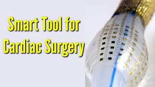 New surgical tools with smart sensors can advance cardiac surgery and therapy