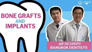 How Long Between A Bone Graft and An Implant Do You Need?