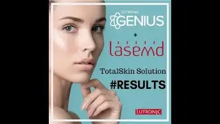 Transform Your Skin at Bella MedSpa | Lutronic Total Solution Revealed!