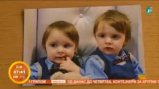 Specifičnosti blizanačke trudnoće