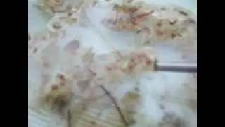 Successful dessicated horse conch egg sac, rehydration and hatching experiment.