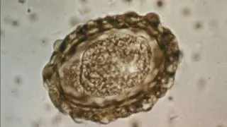 Human Parasite Ascaris (1972)