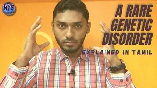 Apert Syndrome | Explained in Tamil | Mohamed Yahya Speaks