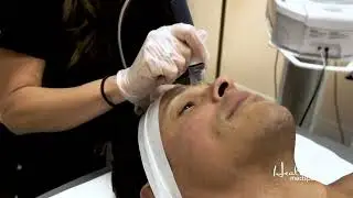 Reveal Your Radiance: Experience Microdermabrasion at Health & Med Spa!