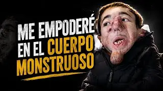 El hombre que vive en un cuerpo ilegal | Matías Burzaco | CJL