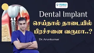 Do Dental Implants Cause Jaw Problems..? | Myths vs Facts | Pearls Dentistry | Chennai