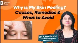 Skin Peeling on Face, Hands or Feet? | Real Reasons & Remedies - Dr. Amee Daxini | Doctors' Circle