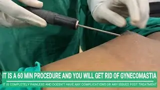 Fastest Way of Getting Rid of Gynecomastia Explained by Top Plastic Surgeon Dr. Arth Shah in India