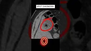 X ray quiz 37 #nursing #nursingstudent #doctor #USMLE  #MBBS, #hospital #anatomy  #ctscan #radiology