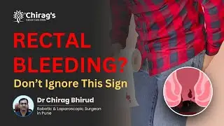 Rectal Bleeding: Piles or Cancer? | Warning Signs Explained | Dr Chirag Bhirud, Pune