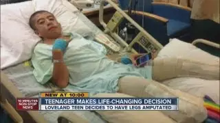 Loveland teen makes painful choice to have legs amputated