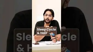 Late Sona = Hair Loss? 😱 Sleep Cycle Ka Shocking Truth #shorts #hairlosstreatment