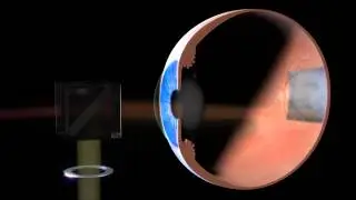SPECTRALIS - Confocal Scanning