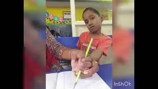 inclusive school in Chennai North Ruthivka therapy center Perambur sri Padma Saraswathi N&P School