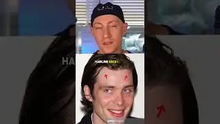 Has Cillian Murphy Had Plastic Surgery?