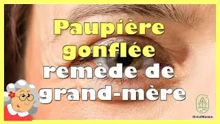 Paupi&egrave;re gonfl&eacute;e rem&egrave;de grand-m&egrave;re
