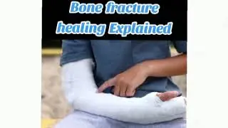 Bone Fracture Healing Visual Representation | Stages of Bone Repair - Easy & Clear