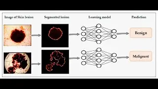 Skin Disease Detection Using Neural Network Python OpenCV Project Source Code