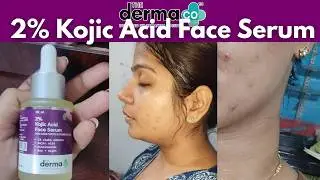 It Actually Works! Derma Co Kojic Acid Serum Tamil Review | 2025 Skin Brightening Results