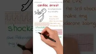 ALS Algorithm | Cardiac Arrest Resus Guide #imgdoctor #nhsjobs