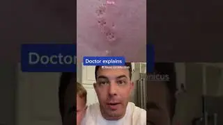 Have you seen a birthmark like this? | 208SkinDoc Dr. Dustin Portela